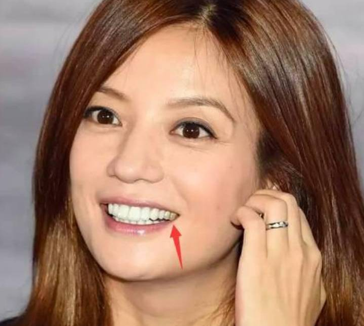 高圆圆|求求明星们，做烤瓷牙时悠着点吧！“夜光大白牙”真的太容易出戏啊