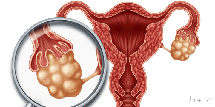 麻麻康|感染了HPV还能做盆底肌康复训练吗？很多人都忽略了这一点