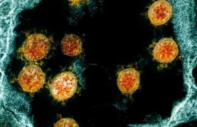 冠状病毒 最新发现！冠状病毒约在3亿年前就已诞生，二人类祖先也曾被感染