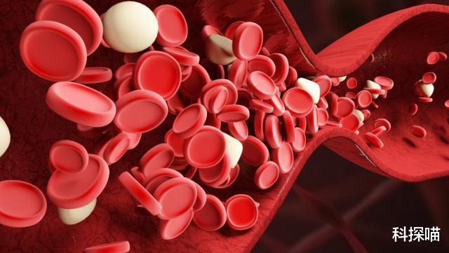 高血脂|85岁奶奶高血脂34年，血管通透，血脂平稳，医生：5件事值得学习