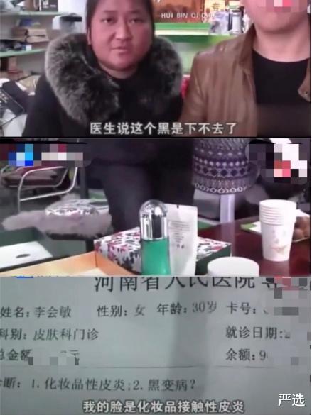 严选|河南女子花8000美白，两月后竟变“包公脸”？医生：难以恢复