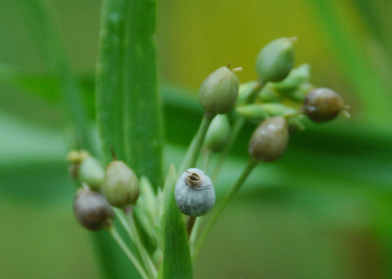 胆固醇|甘油三酯升高会堵住血管，做好这2点，血脂或能安全降低