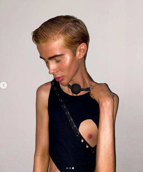 |男星莫名暴瘦自称一切正常，网友们不淡定了：这瘦得诡异