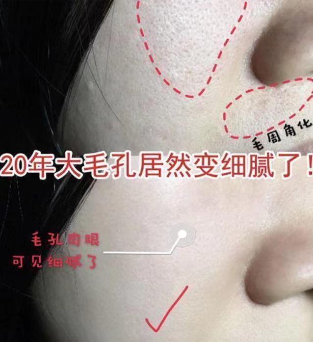 宋智孝|宋智孝为美“全身换血”，护肤升级后，网友：38岁比18岁还年轻