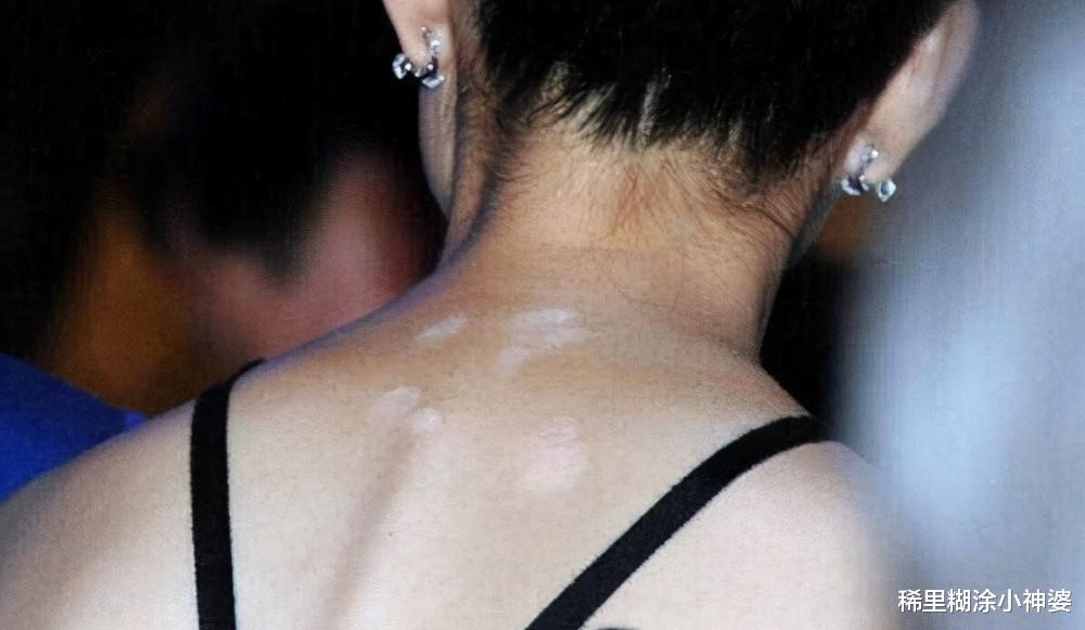 女星全身塗粉，腋窩處色差明顯好尷尬，脖頸上的白斑點是認真的嗎-圖3