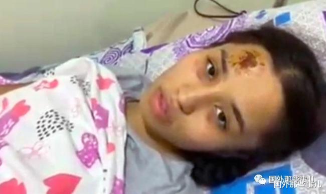 20岁女大学生被院长叫到办公室,反抗对方侵犯后被推出3楼窗户