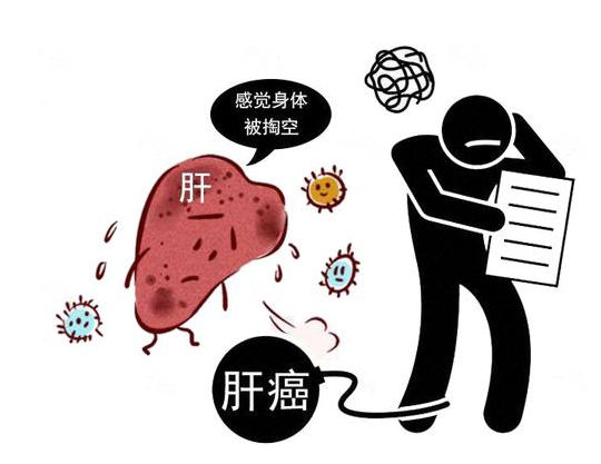 肝脏|体内有癌，肚子第一个发声？这2种异常表现，是肝脏癌变信号？