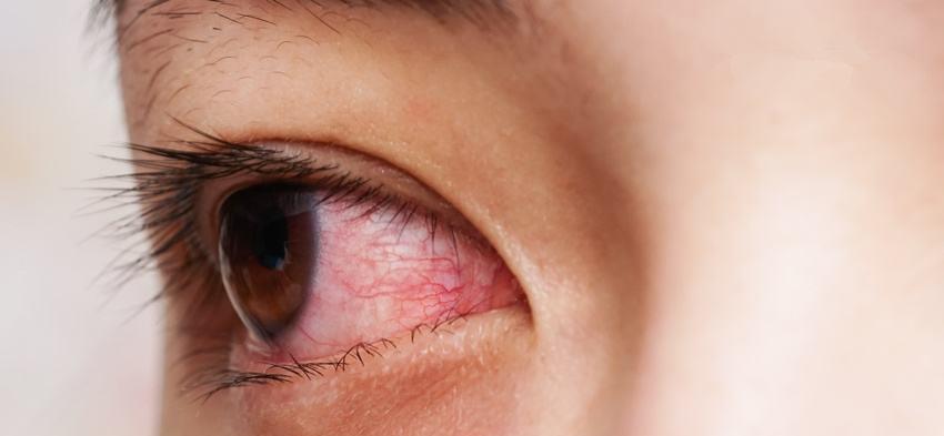 近视|养眼护眼的好方法