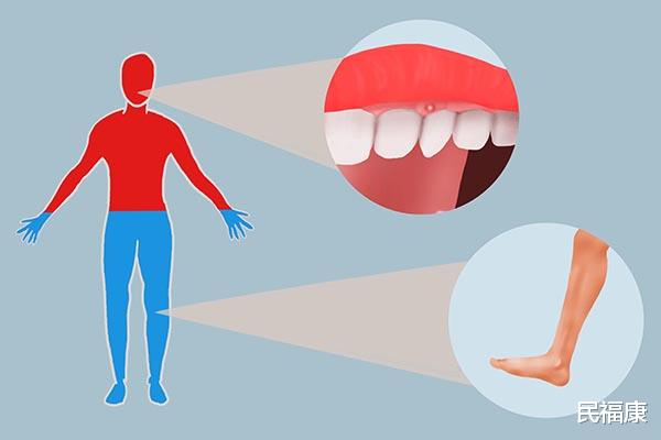 胆囊炎|上火，却又怕冷，“上热下寒”体质该怎么办？给你靠谱的调理建议