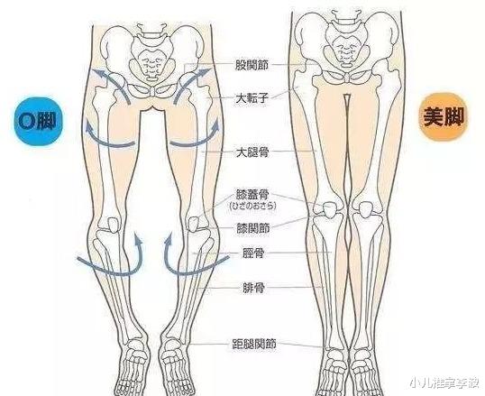 小儿推拿李波|小儿推拿李波：宝宝罗圈腿是怎么回事？怎样预防纠正？常见误区？