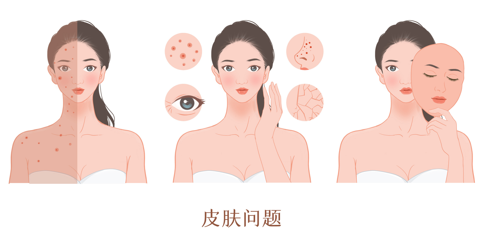 土豆 冬季皮肤会变差？这几个护肤误区，看看你中了几点！