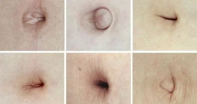 衰老|【原创】看一眼肚脐就知道你啥毛病!别不信!