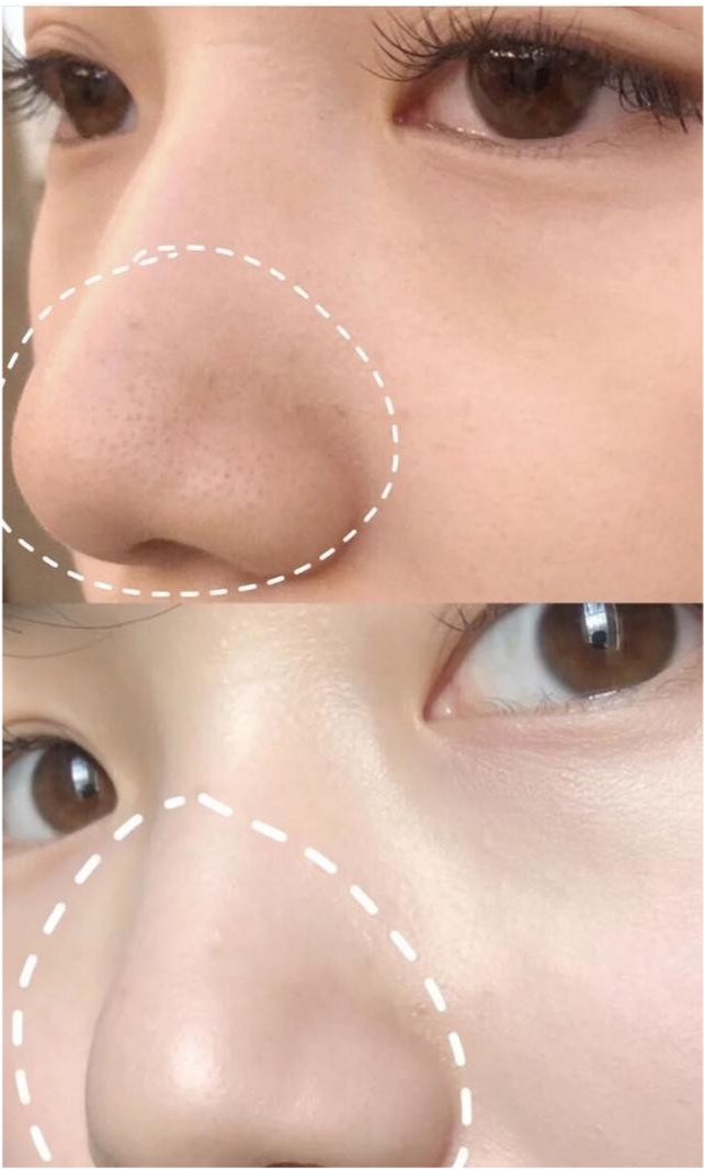 景甜 景甜皮肤好到“没毛孔”，大方分享的“护肤”日常火了，金晨：确实有用