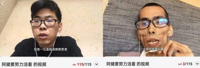 直肠癌|年轻小伙患直肠癌，才一年多就枯瘦如柴？离世前的忠告，引人深思