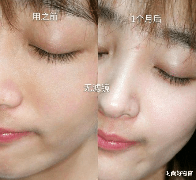 蔬菜|长期使用精华的皮肤，三年后会变成什么样子？说出来你都不敢相信