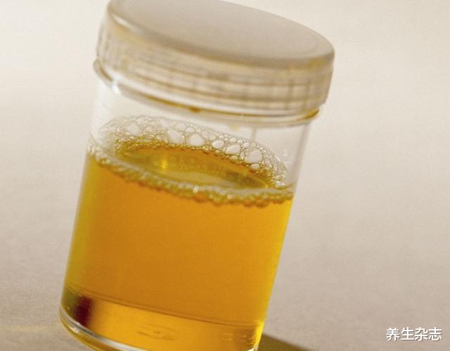 |肝脏变硬,如厕先知?医生坦言:上厕所有4种异常,或是肝病到访