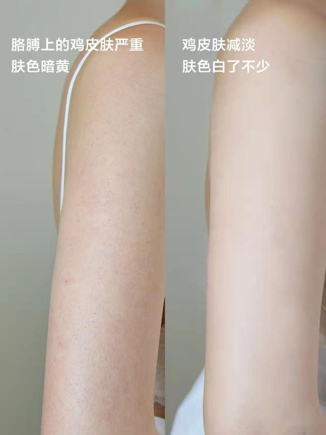 孟美岐 张韶涵“好肌肤”获赞，犹如剥壳鸡蛋，分享的“身体乳”成亮点！