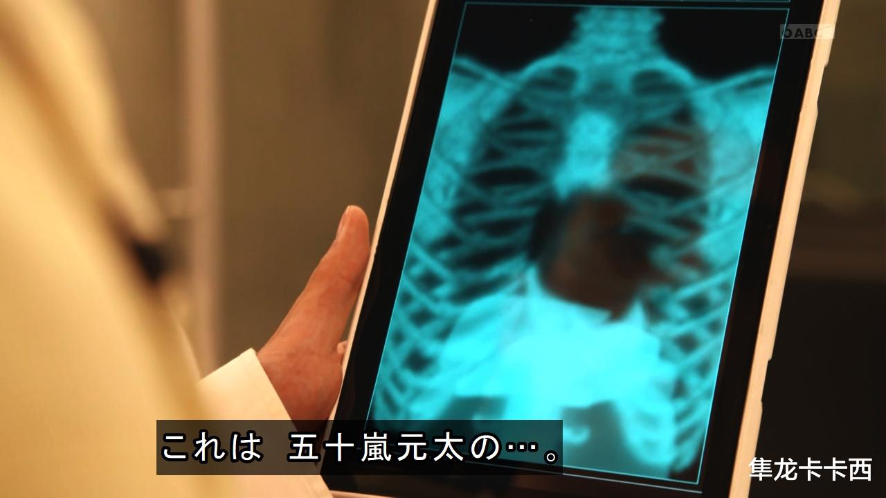 |假面骑士revice剧情起飞：五十岚老爹没有心脏 E总：这剧情眼熟