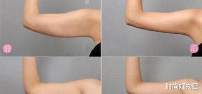 时尚好物官 发福了！47岁袁立被偶遇，体态臃肿大腿粗壮抢镜。瘦下来好看多了