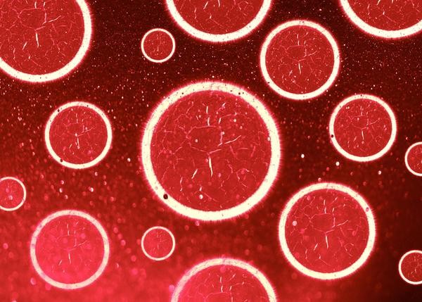 疾病|肾实质损伤,这几个因素请多加防范,避免肾脏纤维化