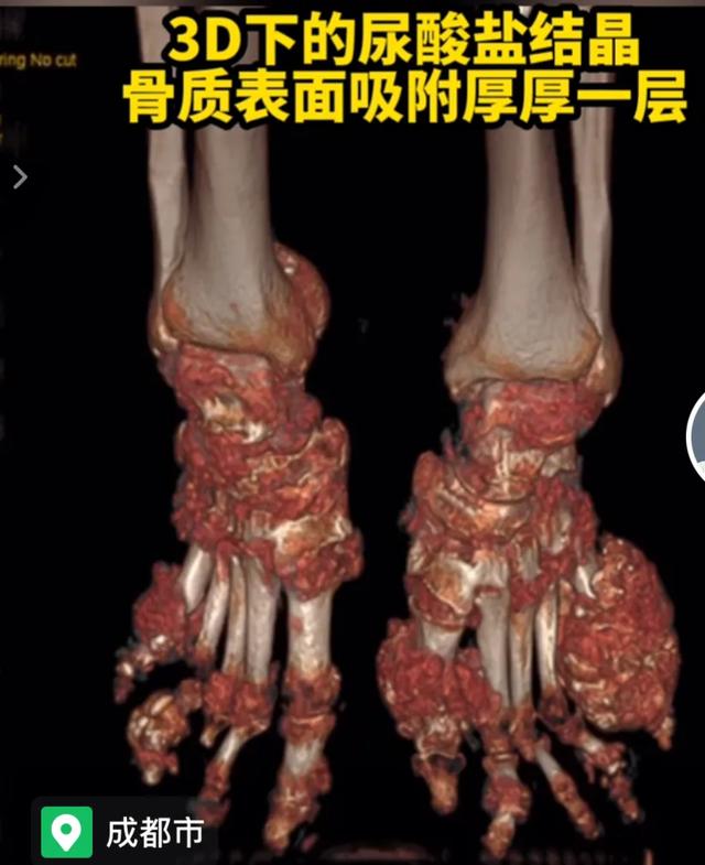 吴嘉情吧 爱上喝时尚的奶茶十年后
