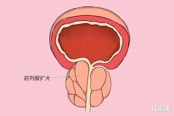 苹果|每天吃2个苹果，坚持一个月，身体有何变化？