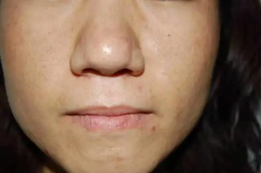 补钙|食品网联合呼吁:1塑料袋别再放冰箱,或会导致肝脏癌变,趁早扔