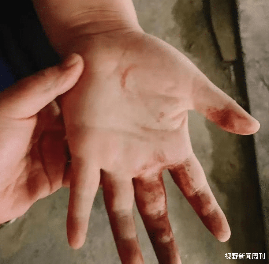 视野新闻周刊 武汉暴风雨致2工人被困吊篮，多次撞击大楼致死，家属发声：被用工单位围殴、抢手机、抢尸体