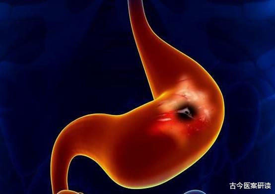 水果|吃一口等于伤一次胃！这3个水果已被列进“黑名单”，胃不好的少吃