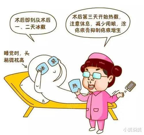 小美说美 双眼皮手术安全吗？割双眼皮是永久的吗？