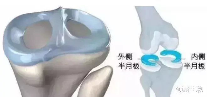  用干细胞来修复半月板损伤或是未来趋势