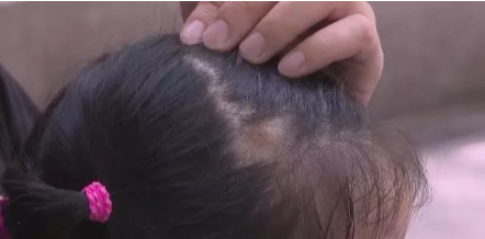 深圳查查吧 这种“夺命小黑点”又开始活动了！深圳人外出千万要注意