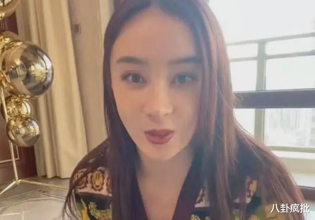 张雨绮|张雨绮脸僵鼻子怪，过度医美惹的祸？