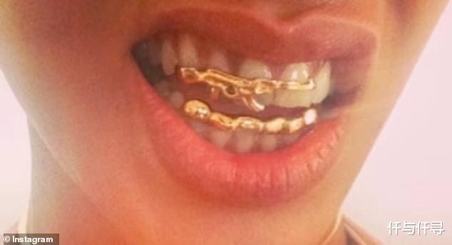 霞光|是时候摘掉口罩了!后疫期时代珠宝趋势:下巴扣、牙套牙钻大流行