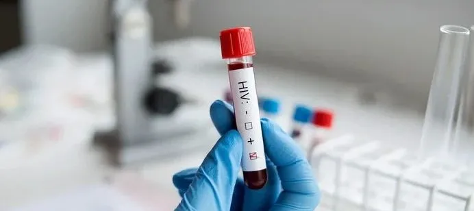  碰到HIV/艾滋病毒感染者的血，会被传染吗？