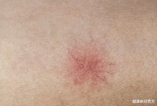 健康新经官方 26岁女子频繁腹痛，查出肝癌，肝科医生：如厕2个异常，趁早检查