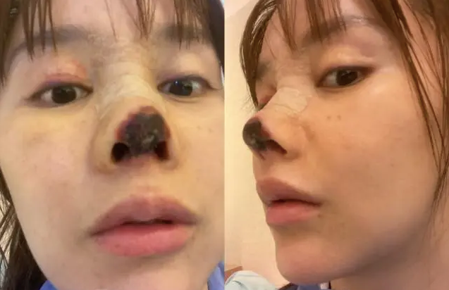 整容|8位因整容而“塌房”的女星,明明长得美艳动人,为何还要动刀?