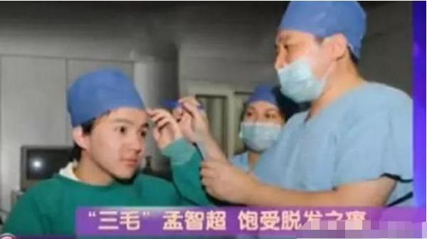 孟智超|他凭“三毛”一夜爆红，后因谢顶缝合300针，今容貌大变已无人识！