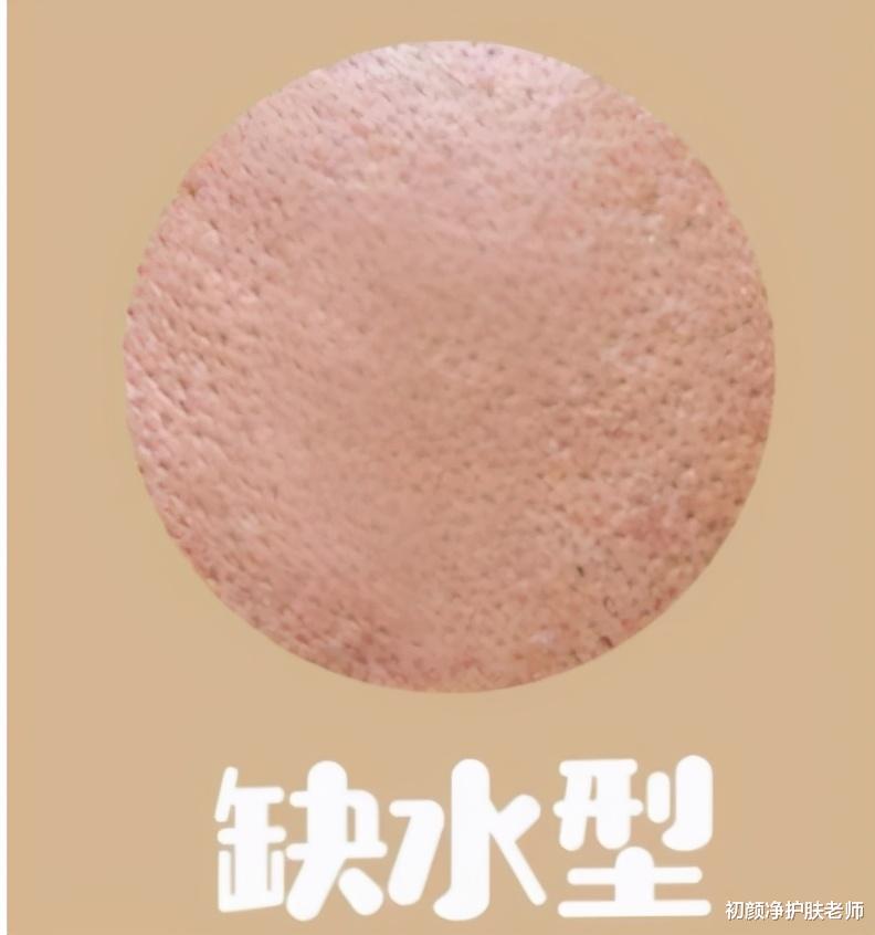 发型 “毛孔粗大”怎么办？确定类型、对症解决，才能有效收缩毛孔！