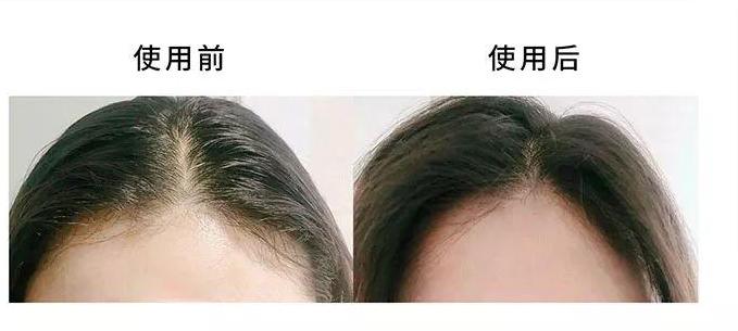 发型|讲真，显“廉价感”的女孩，头发都有这些特征