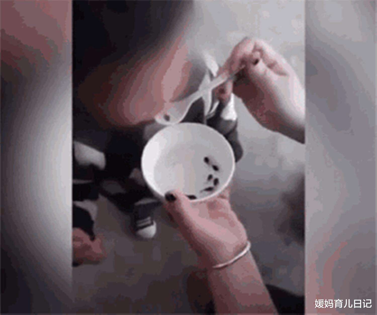 媛妈育儿日记|11岁女孩长虱子，妈妈用农药焗头致其进手术室，愚昧育儿太可怕