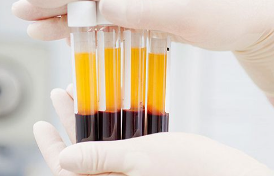 抗体 超70%感染者抗体呈阳性，中国专家发布重磅报告，人类能松一口气？