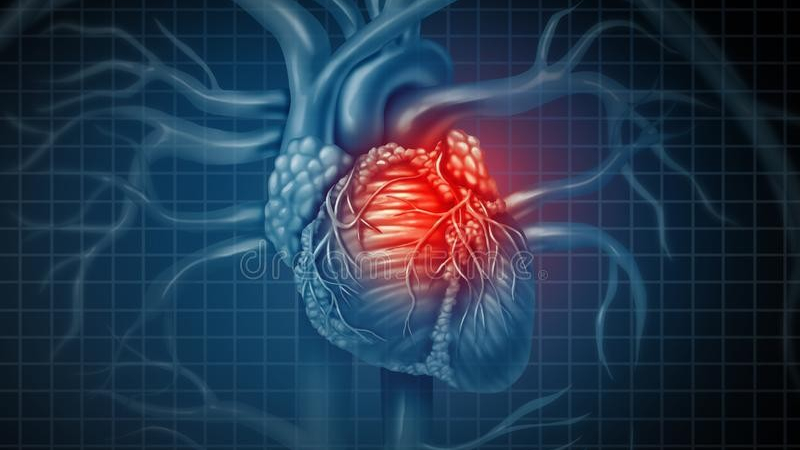 谈健|心脏支架手术是不是一劳永逸？术后该注意哪些问题？一文说清