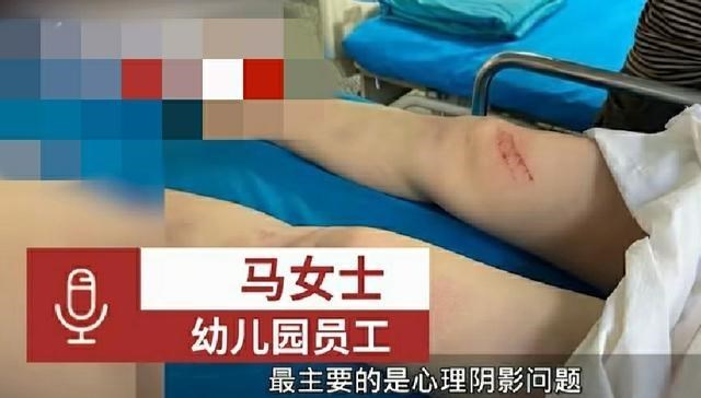 皓月长星|成都一名女幼师被殴打致2肋骨断裂