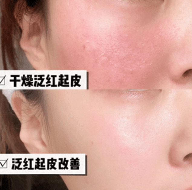 面霜|张馨予分享“万能”面霜，价格便宜不输大牌，袁咏仪：平价兰蔻