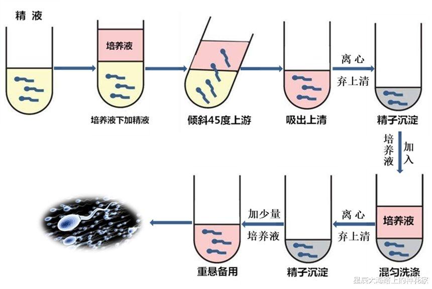 人工授精 看呆医生：一次成功！嫌医院人工授精太贵，英女子硬核DIY操作