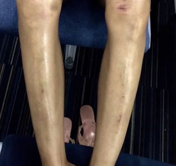 影史|跆拳道冠军登上装女郎!成为成龙御用女星