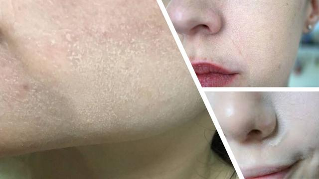 好物官|有种“尴尬”叫女明星关掉美颜!刘亦菲全脸卡粉,朱莉像在砌墙