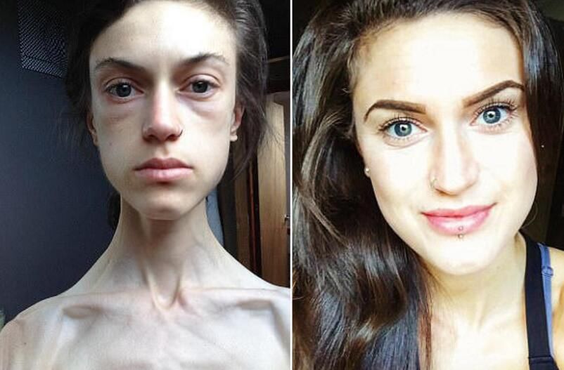 护肤|女人如何像赵雅芝那样优雅地老去？一次性告诉你抗衰老的10个方法