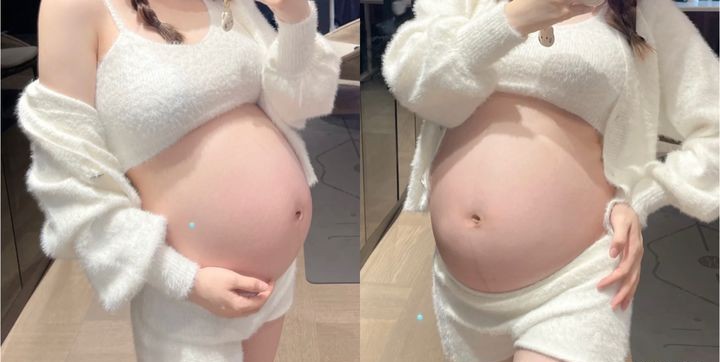 樱桃妈咪|7天就能祛除妊娠纹？别交智商税！产后淡化3步曲，宝妈一步不能落